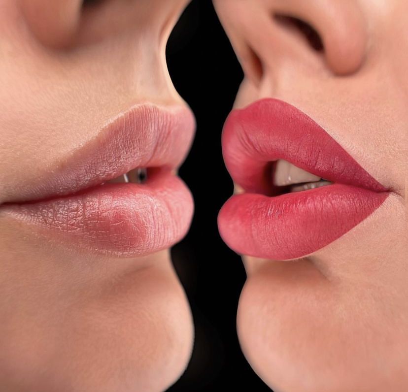 Môi bị xỉn màu sau Tết: Nguyên nhân và cách phục hồi bằng phun môi 2 Môi bị xỉn màu sau Tết: Nguyên nhân và cách phục hồi bằng phun môi