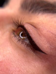 Phun mí có ảnh hưởng thị lực không? Những điều cần biết trước khi làm