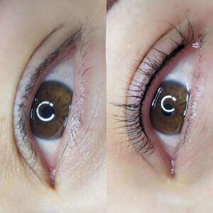 Phun mí mắt có nguy hiểm không? Những lưu ý quan trọng trước khi làm