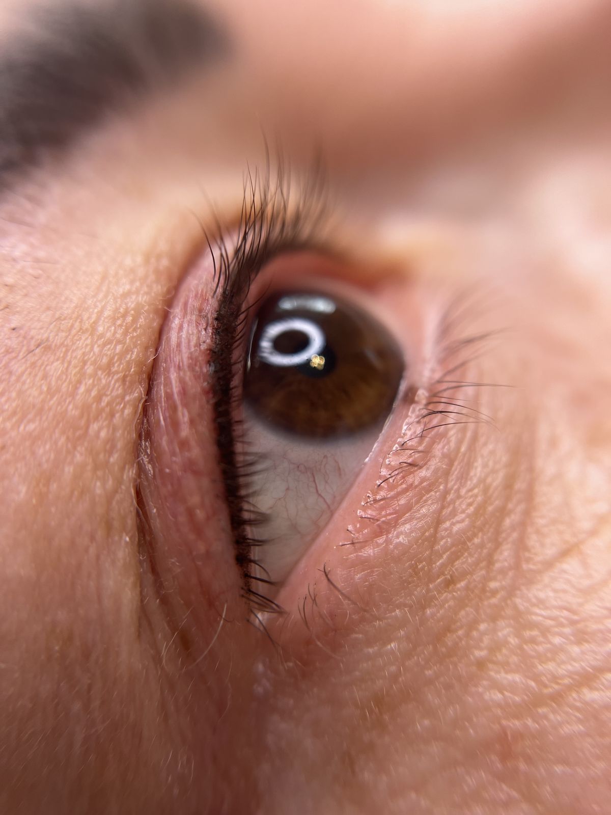 Phun mí mở tròng là gì? Có làm mắt to hơn thật không? 1 Phun mí mở tròng là gì? Có làm mắt to hơn thật không?