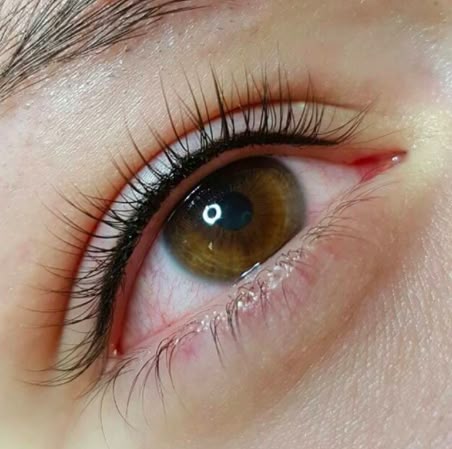 Phun mí trên – mí dưới khác nhau thế nào? Chuyên gia giải đáp