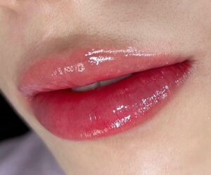 Phun môi Collagen có tốt không? Những điều cần biết trước khi làm