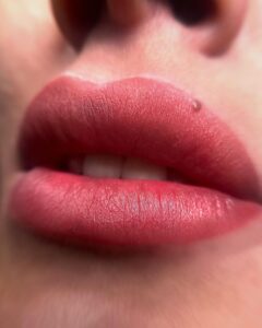 Phun môi có đau không? Giải đáp từ góc nhìn chuyên môn