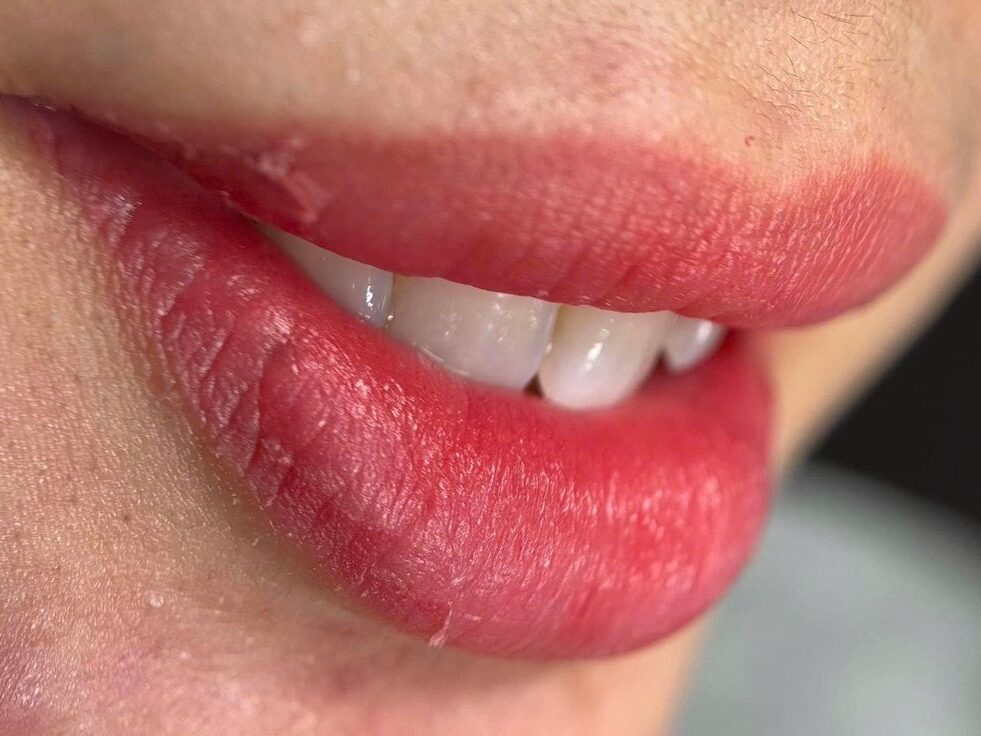 Phun môi collagen là gì? Có thật sự giúp môi căng bóng, bền màu?