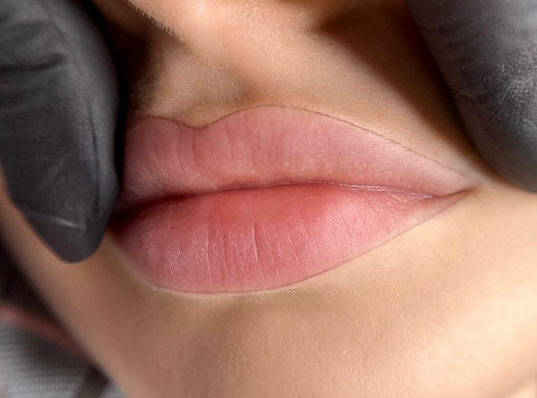 Phun môi không đau có thật không? Sự thật từ góc nhìn kỹ thuật