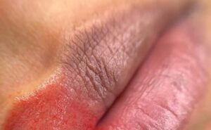 Phun môi thâm: Nguyên nhân, lộ trình xử lý & sai lầm cần tránh