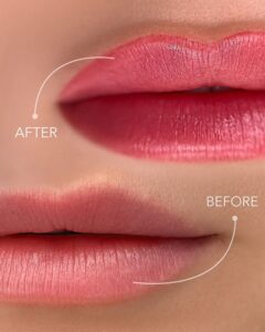 Phun môi sau Tết có phù hợp không? Thời điểm vàng để làm đẹp