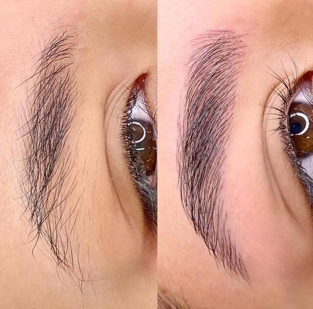 Vì sao phun xăm bị trổ xanh, trổ đỏ sau thời gian?