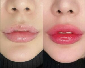 Vì sao môi sau phun có người bong đẹp, có người lại bong loang từng mảng?