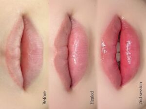 phun môi nhiều lần