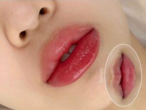 Phun môi đẹp là nhìn thấy ngay hay phải chờ đúng chu kỳ môi hồi phục?