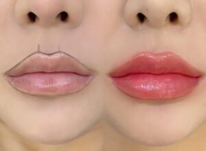 Phun môi công nghệ mới có thật sự không cần kiêng ăn như lời quảng cáo?