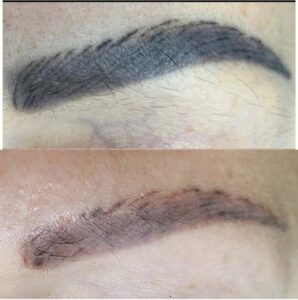 5 sai lầm phổ biến khiến phun mày bị trổ xanh đỏ