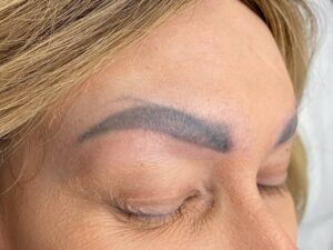 Phun mày bị trổ xanh đỏ phải làm sao? Cách xử lý an toàn