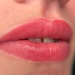 Phun môi Collagen có tốt không? Đánh giá khách quan và cập nhật mới nhất