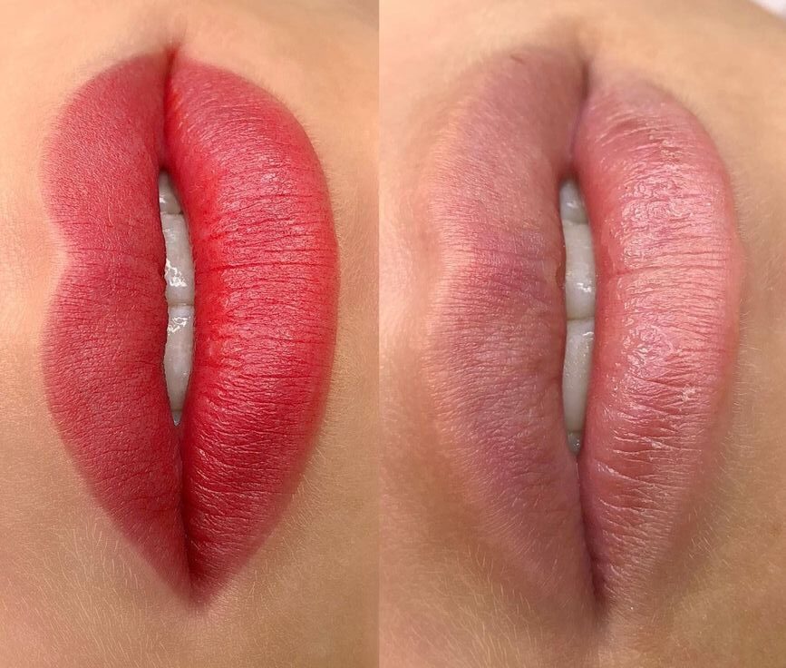 Phun môi Nano giá bao nhiêu? Bảng giá mới nhất và lưu ý quan trọng 1 Phun môi Nano giá bao nhiêu? Bảng giá mới nhất và lưu ý quan trọng