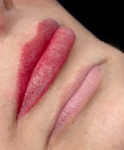 Phun môi bị thâm, loang màu: Nguyên nhân và cách xử lý an toàn