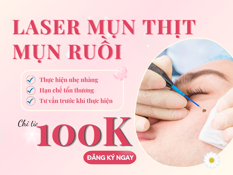 Liệu sau khi tẩy nốt ruồi có được ăn đồ ngọt không? 4 Phun xam may8