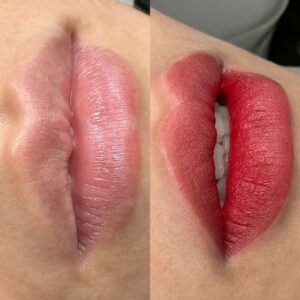 So sánh phun môi lụa và phun môi collagen – Đâu là lựa chọn tốt hơn?